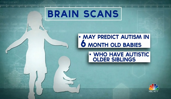 Thoughts On Hugs Predict Autism >> 2017 Study Brain Scans Could Predict Autism In Babies Thoughts On Hugs Predict Autism >> 2017 Study Brain Scans Could Predict Autism In Babies